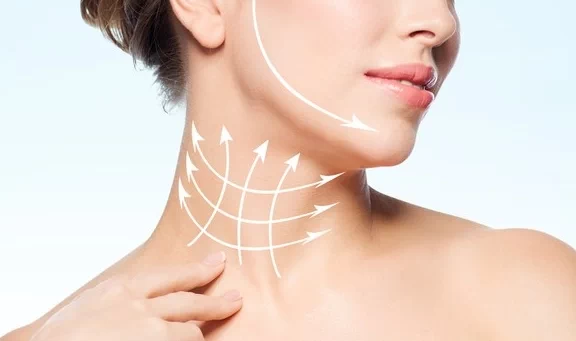 Botox no Platisma